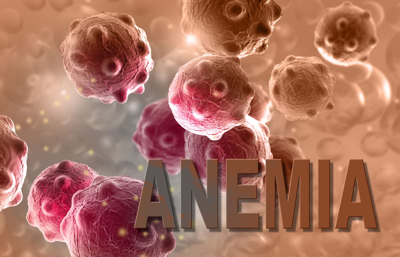 Anemia: Causes